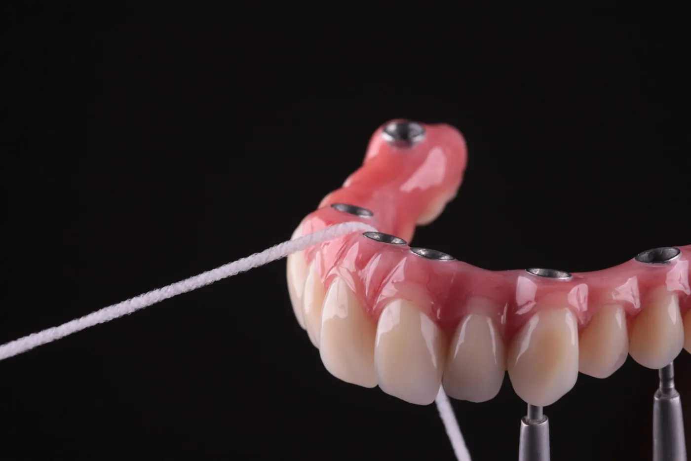Prótese fixa e implantes